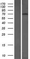 BTBD9 Human Over-expression Lysate