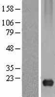 Caveolin 3 (CAV3) Human Over-expression Lysate