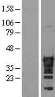 CDX2 Human Over-expression Lysate