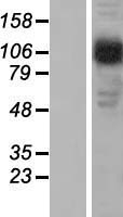 AP2B1 Human Over-expression Lysate