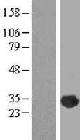 CLIC2 Human Over-expression Lysate