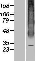 Aquaporin 6 (AQP6) Human Over-expression Lysate