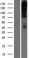 ATP2B4 Human Over-expression Lysate