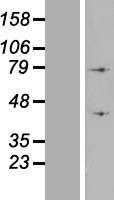 ATP6V1A Human Over-expression Lysate