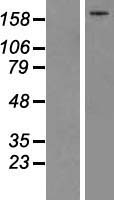Complement C5 (C5) Human Over-expression Lysate