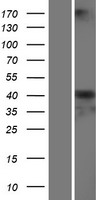 SERPINA6 Human Over-expression Lysate