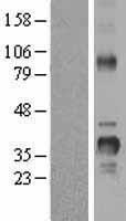 Cyclin D2 (CCND2) Human Over-expression Lysate