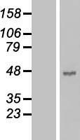 Carboxypeptidase B (CPB1) Human Over-expression Lysate