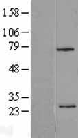 beta Casein (CSN2) Human Over-expression Lysate