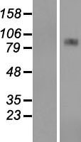 CPT1A Human Over-expression Lysate