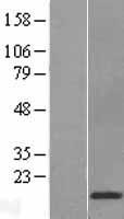 Cystatin D (CST5) Human Over-expression Lysate