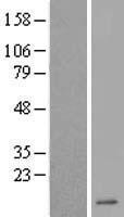 DEFA6 Human Over-expression Lysate