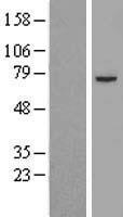 Pyruvate Dehydrogenase E2 (DLAT) Human Over-expression Lysate