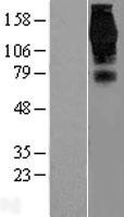 EPS15 Human Over-expression Lysate