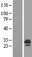 ETFB Human Over-expression Lysate