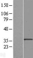 HLA-DOA Human Over-expression Lysate