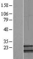 NDUFB5 Human Over-expression Lysate