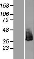 Nucleophosmin (NPM1) Human Over-expression Lysate