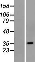 POU6F1 Human Over-expression Lysate
