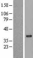 PP1C gamma (PPP1CC) Human Over-expression Lysate