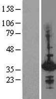 Hex (HHEX) Human Over-expression Lysate