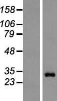 Proteasome subunit alpha type 6 (PSMA6) Human Over-expression Lysate