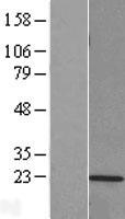 PSMB9 Human Over-expression Lysate