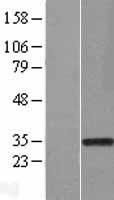 RAD1 Human Over-expression Lysate