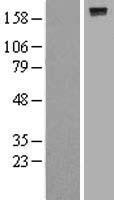DEP1 (PTPRJ) Human Over-expression Lysate
