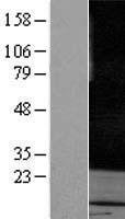 RAB3A Human Over-expression Lysate