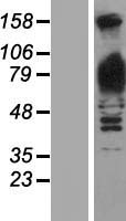 GPBB (PYGB) Human Over-expression Lysate