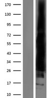RAC2 Human Over-expression Lysate