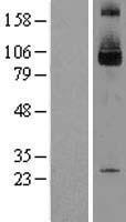 SKI Human Over-expression Lysate