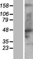 nSMase (SMPD2) Human Over-expression Lysate