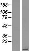 Statherin (STATH) Human Over-expression Lysate