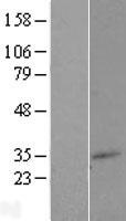 TM7SF2 Human Over-expression Lysate