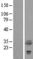TPM4 Human Over-expression Lysate