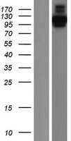 CYLN2 (CLIP2) Human Over-expression Lysate