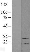 VIP Human Over-expression Lysate