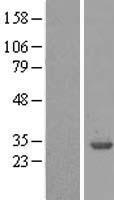14-3-3 beta (YWHAB) Human Over-expression Lysate