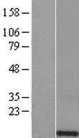 H4C13 Human Over-expression Lysate