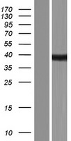 SPT3 (SUPT3H) Human Over-expression Lysate