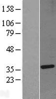 Gemin 2 (GEMIN2) Human Over-expression Lysate