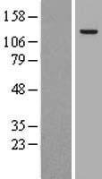 HPS2 (AP3B1) Human Over-expression Lysate