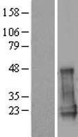 CGGBP1 Human Over-expression Lysate