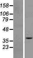 OR6A2 Human Over-expression Lysate