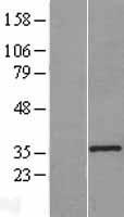 KLF7 Human Over-expression Lysate