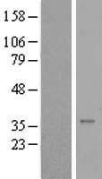 Syntaxin 16 (STX16) Human Over-expression Lysate