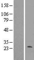 MRPL40 Human Over-expression Lysate