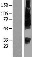 SLC13A2 Human Over-expression Lysate